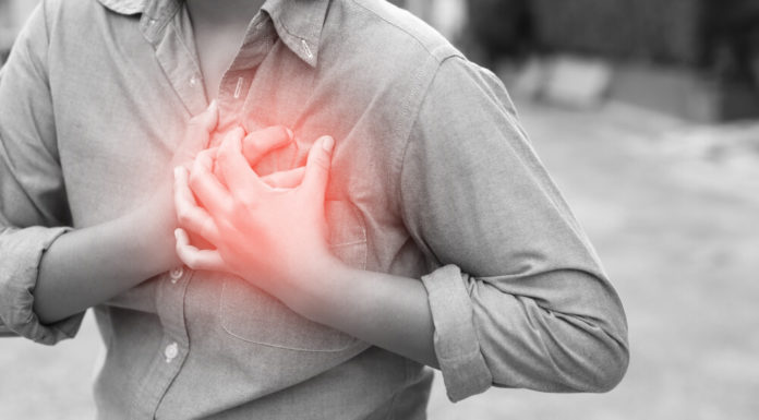 Infarkt miokarda (srčani udar) – Šta podrazumeva i koji su simptomi infarkta Infarkt miokarda