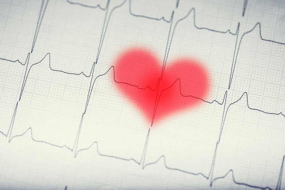 Kako se leči srčani udar